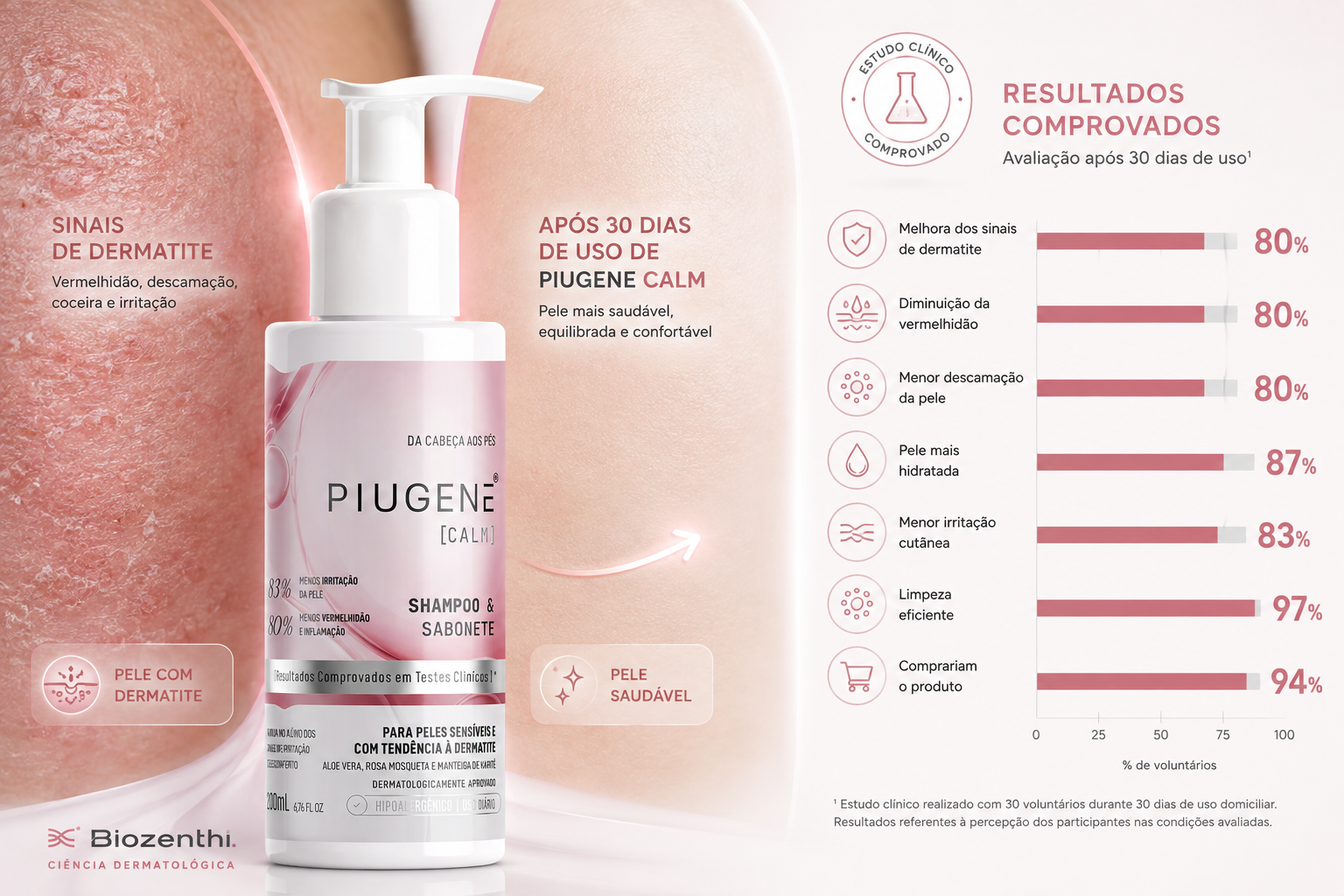 Estudo clínico demonstra melhora da dermatite, coceira, vermelhidão e descamação com formulação dermatológica Piugene Calm
